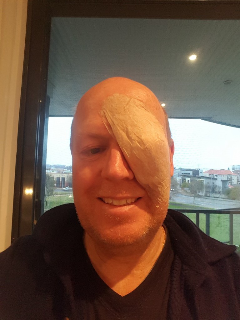 Selfie - Eye Patch